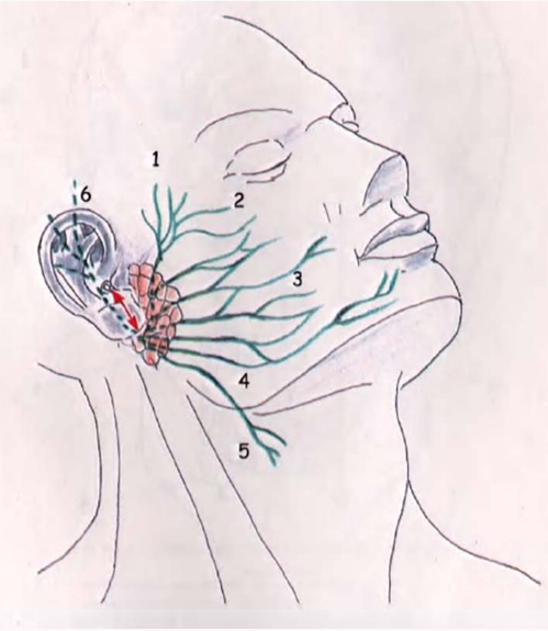Лицевой нерв слева. Краевая ветвь лицевого нерва топография. Электронейрография тройничного нерва. Неврит нижнечелюстного нерва. Проекция нижнечелюстного нерва.
